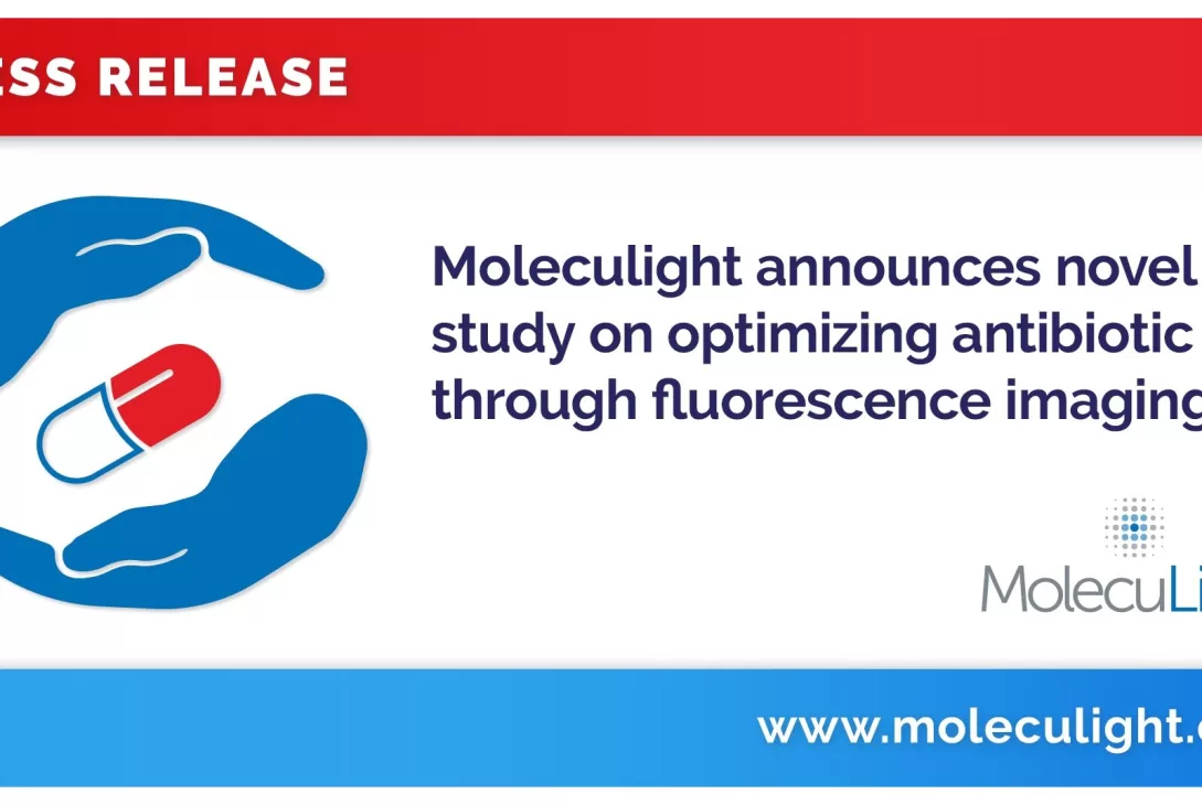 Moleculight